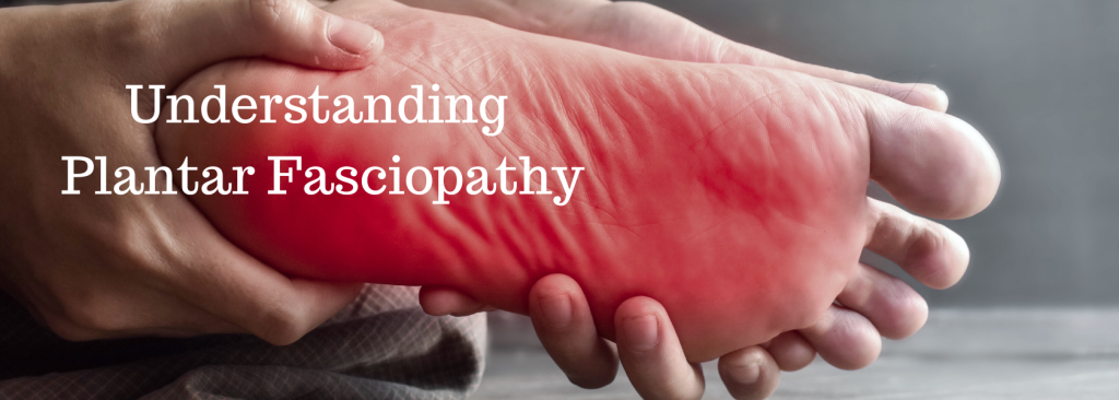 Understanding Plantar Fasciopathy